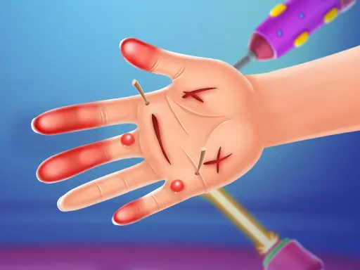 Hand Doctor - Play Free Hand Surgery Game Online