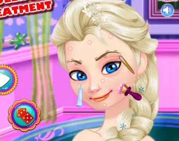 Ice Queen Akne Behandlung – Schönheitsspiel für Mädchen